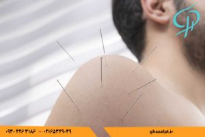 فیزیوتراپی غزال در اندیشه خدمات سوزن خشک را در محیطی بهداشتی و با استفاده از تجهیزات پیشرفته برای تسکین دردهای عضلانی ارائه می‌دهد.