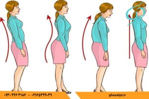 انجام حرکات اصلاحی در فیزیوتراپی در اندیشه