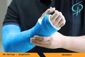 چرا بعد از شکستگی استخوان باید فیزیوتراپی بریم؟