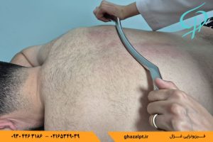 کاربرد ابزار گراستون در فیزیوتراپی 