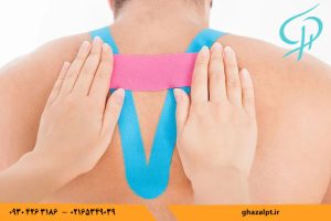 اجرای تیپینگ کشسان روی شانه برای کاهش درد، اصلاح وضعیت بدنی و حمایت از مفصل در کلینیک فیزیوتراپی غزال