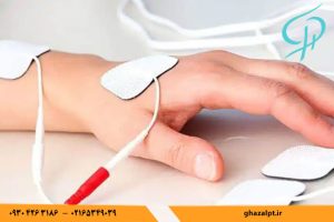 استفاده از لیزر پرتوان و تجهیزات پیشرفته برای کاهش التهاب و تسریع درمان درد مچ دست در کلینیک فیزیوتراپی غزال.
