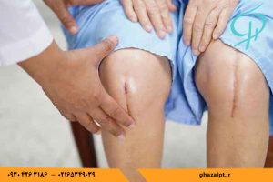 فیزیوتراپی زخم چیست ؟ درمان زخم چگونه است ؟