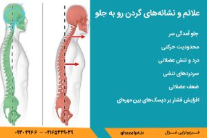 علائم اصلی ناهنجاری گردن رو به جلو چیست؟