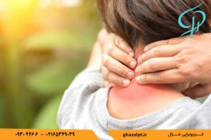 درمان گرفتی با فیزیوتراپی 