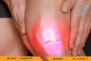 علت و روش های درمان ساییدگی زانو 