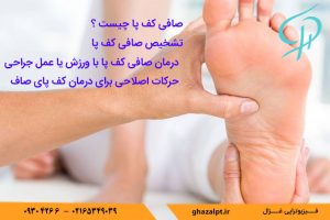 درمان صافی کف پا با فیزیوتراپی
