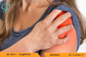 پارگی تاندون چیست؟