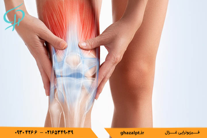 آرتروز زانو چیست؟