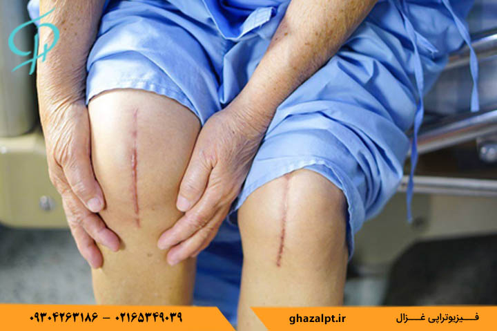 چرا بعد از جراحی مفاصل خشک می شود؟